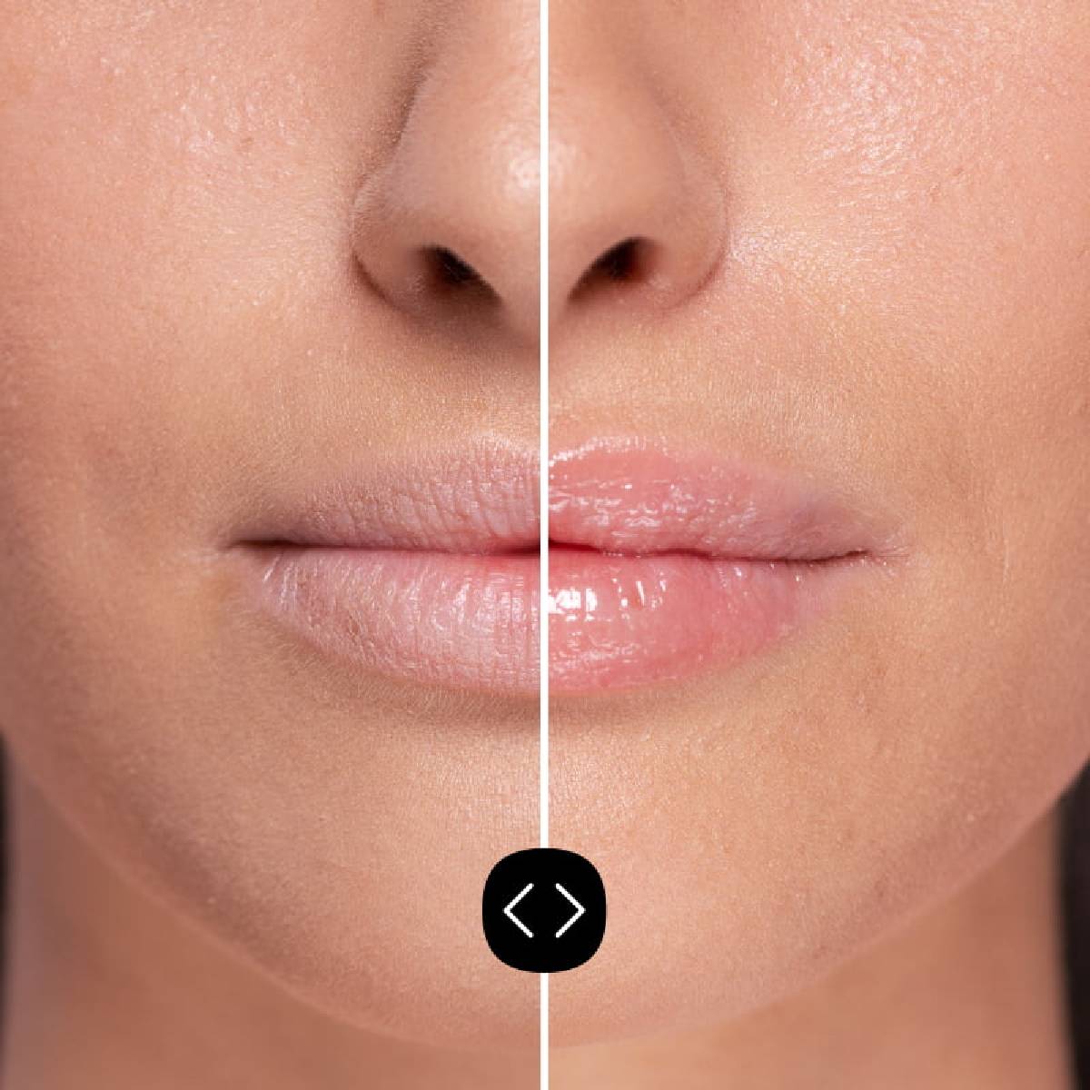 Freshly Hyaluronic Lip Plumper 5ml
