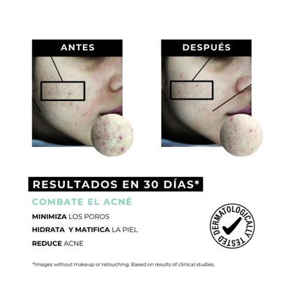 Equilibrium creme anti-acne para pele oleosa Arganour 30ml