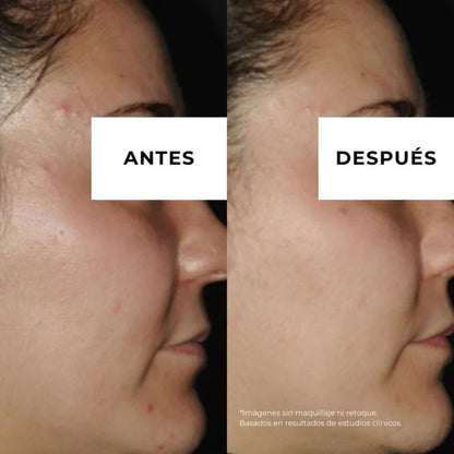 Equilibrium creme anti-acne para pele oleosa Arganour 30ml