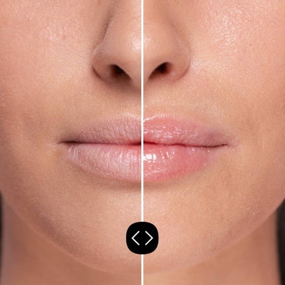 Freshly Hyaluronic Lip Plumper 5ml